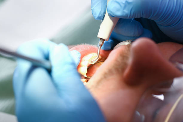 Best Broken or Chipped Tooth Repair in Minco, OK