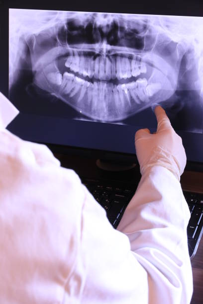 Best Emergency Root Canal Therapy in Minco, OK